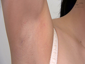 素人娘の全裸図鑑34　今時の女の子11名が恥らいながら脱衣していく様子をじっくり撮影した、変態紳士のためのヘアヌードコレクション　サンプル画像15